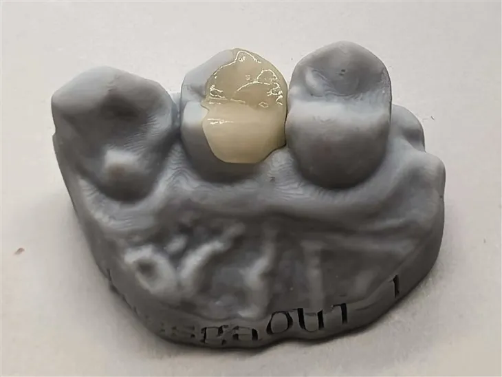 Otantik Onlay konpoze pou yon pi bon pri