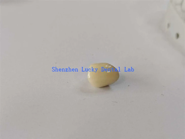 Lachin dantè PFM Co Cr Crown Laboratwa